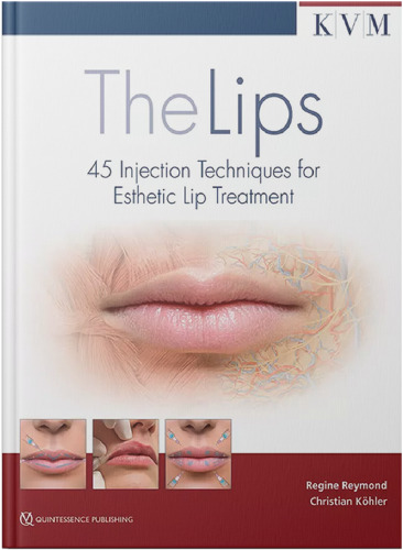 The lips - 45 injection techniques for esthetic lip treatment